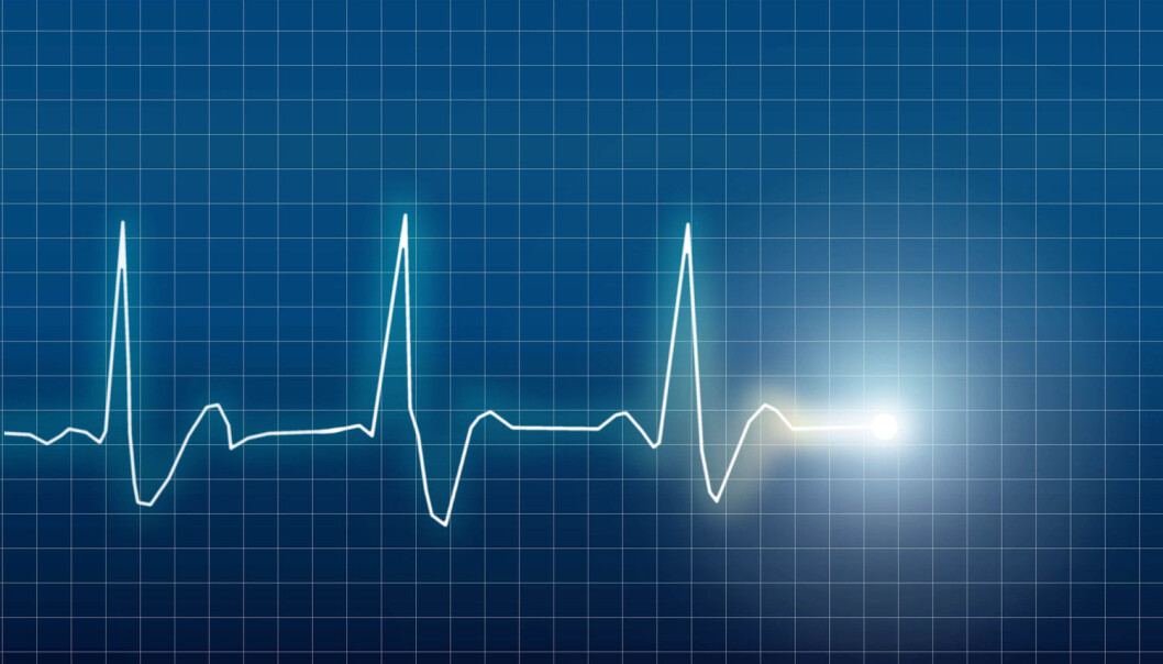 Illustrasjon av elektrokardiogram (EKG) av et hjerte (Foto: Eskemar / Shutterstock / NTB scanpix) Illustrasjon av elektrokardiogram (EKG) av et hjerte (Foto: Eskemar / Shutterstock / NTB scanpix)