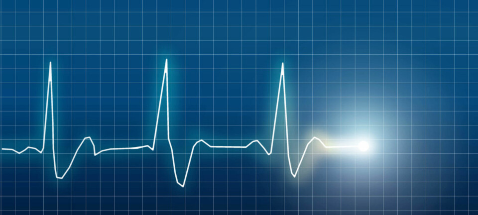 Illustrasjon av elektrokardiogram (EKG) av et hjerte (Foto: Eskemar / Shutterstock / NTB scanpix)
