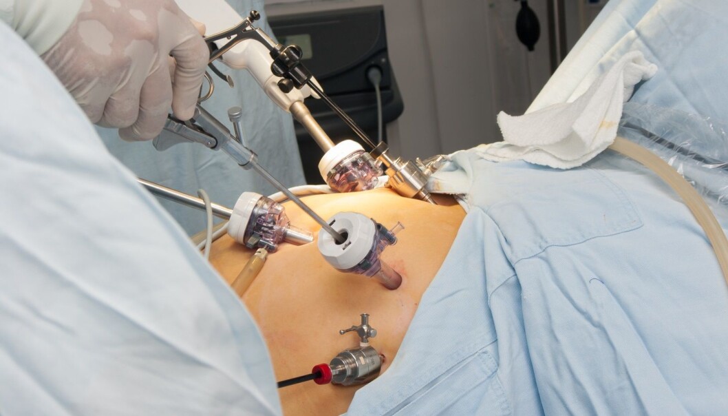 Fedmeoperasjon er ikke risikofritt. Gastrisk bypass kan gi alvorlig tarmslyng, men en spesiell kirurgisk metode reduserer risikoen. (Foto: herjua/Shutterstock/NTB scanpix) Fedmeoperasjon er ikke risikofritt. Gastrisk bypass kan gi alvorlig tarmslyng, men en spesiell kirurgisk metode reduserer risikoen. (Foto: herjua/Shutterstock/NTB scanpix)