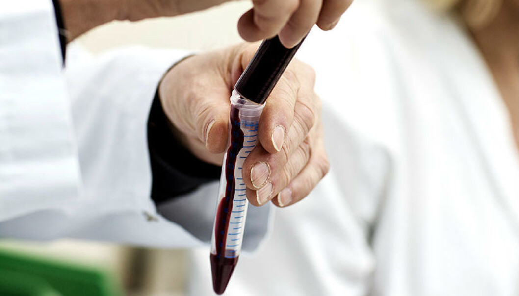 Det finnes ulike medisiner mot kreftformen myelomatose, men problemet er at pasientene som regel utvikler resistens etter en tids bruk. Forskere ved NTNU har testet to av medisinene på celler fra blodkreftpasienter. Funnene deres belyser hvorfor kreftcellene etter hvert tåler kreftmedisinen. (Foto: Geir Mogen / NTNU) Det finnes ulike medisiner mot kreftformen myelomatose, men problemet er at pasientene som regel utvikler resistens etter en tids bruk. Forskere ved NTNU har testet to av medisinene på celler fra blodkreftpasienter. Funnene deres belyser hvorfor kreftcellene etter hvert tåler kreftmedisinen. (Foto: Geir Mogen / NTNU)