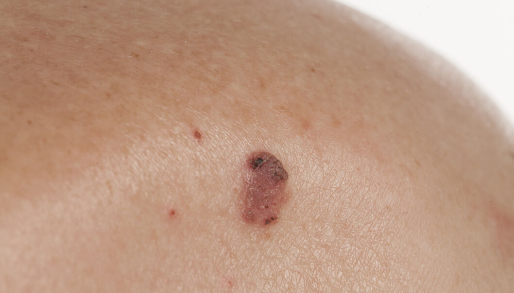 Kreftceller og normale naboer jobber sammen for å beskytter kreftcellene mot behandling. (Foto: Shutterstock / NTB scanpix) Kreftceller og normale naboer jobber sammen for å beskytter kreftcellene mot behandling. (Foto: Shutterstock / NTB scanpix)