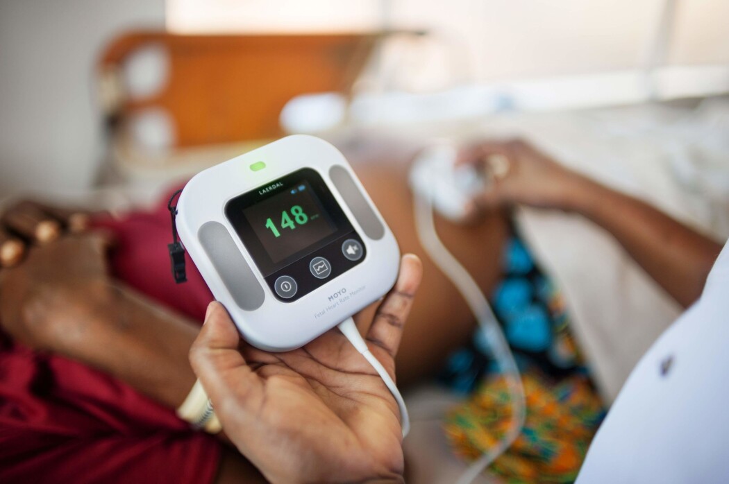 Et nytt verktøy kan gi leger muligheten til å overvåke fosterlyd gjennom hele svangerskapet. (Foto: Laerdal Global Health) Et nytt verktøy kan gi leger muligheten til å overvåke fosterlyd gjennom hele svangerskapet. (Foto: Laerdal Global Health)