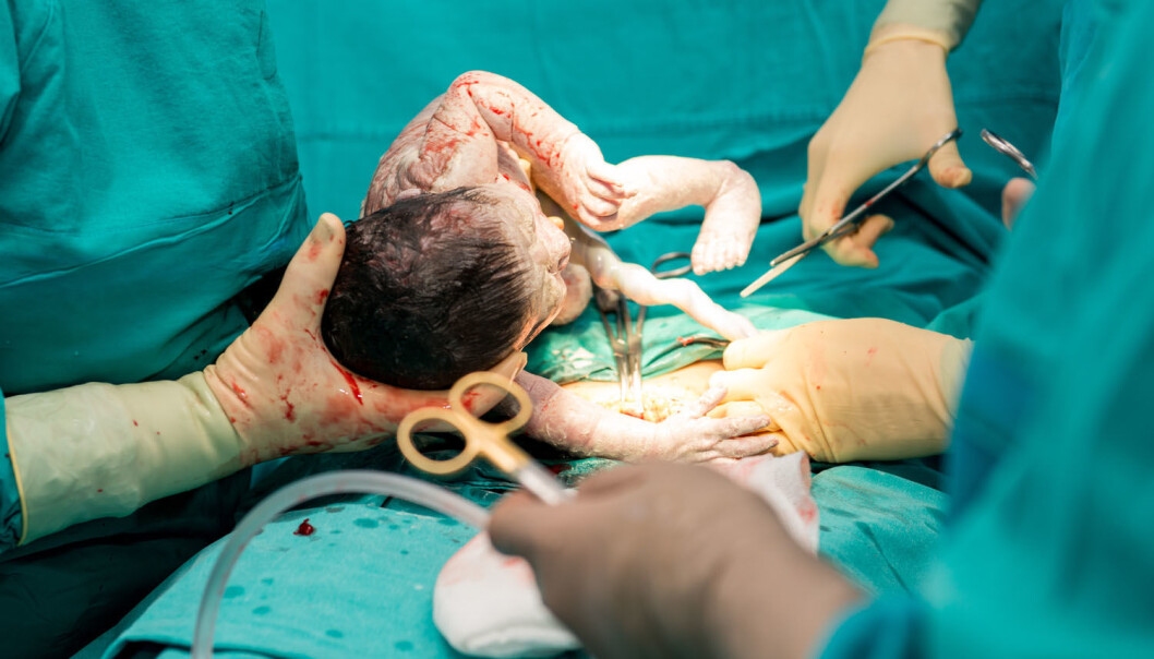 En ny studie støtter hypotesen om at fødselsmåten kan påvirke risikoen for å få fedme senere i livet. (Foto: Nasimi Babaev / Shutterstock / NTB scanpix) En ny studie støtter hypotesen om at fødselsmåten kan påvirke risikoen for å få fedme senere i livet. (Foto: Nasimi Babaev / Shutterstock / NTB scanpix)