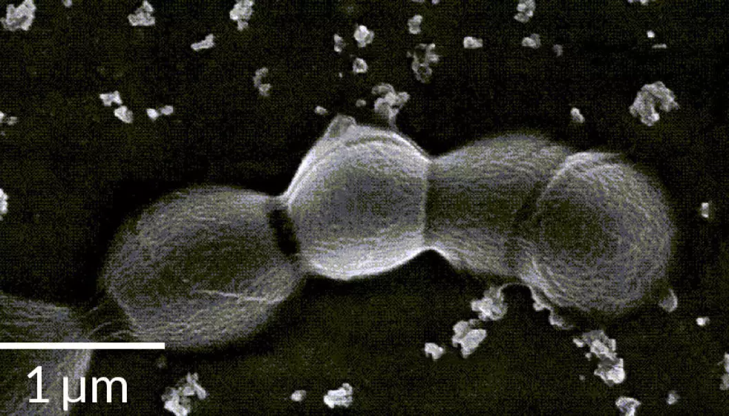 Bilde av en GBS som slipper ut vesikler med etsende proteiner M.V. Surve et al/PLOS Pathogens 2016