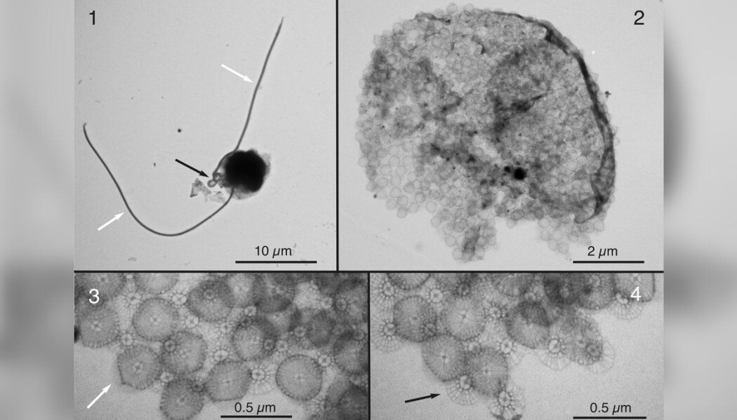 Bilde av Chrysochromulina leadbeateri. Bilde 1 viser hele algen, de andre er nærbilder av ulike deler av den. Denne algen er så liten at forskerne må bruke elektronmikroskop for å få detaljbilder av den. (Foto: Wenche Eikrem og Antje Hofgaard, Universitet i Oslo (etter avtale)) Bilde av Chrysochromulina leadbeateri. Bilde 1 viser hele algen, de andre er nærbilder av ulike deler av den. Denne algen er så liten at forskerne må bruke elektronmikroskop for å få detaljbilder av den. (Foto: Wenche Eikrem og Antje Hofgaard, Universitet i Oslo (etter avtale))