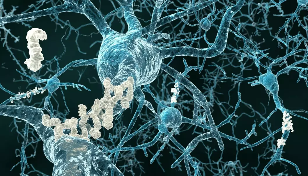 Ny medisin mot Alzheimer viser lovende resultater