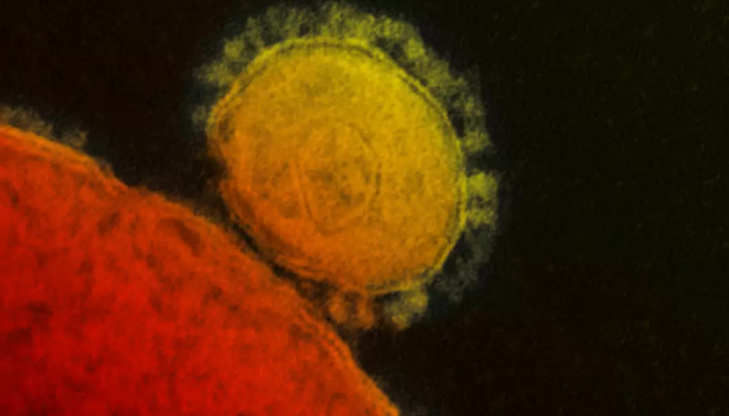 MERS-viruset, her fotografert med et elektronmikroskop, er sykdomsfremkallende. Men mange av virusene vi har i kroppen kan være harmløse, eller til og med nyttige.  (Foto: National Institutes of Health)