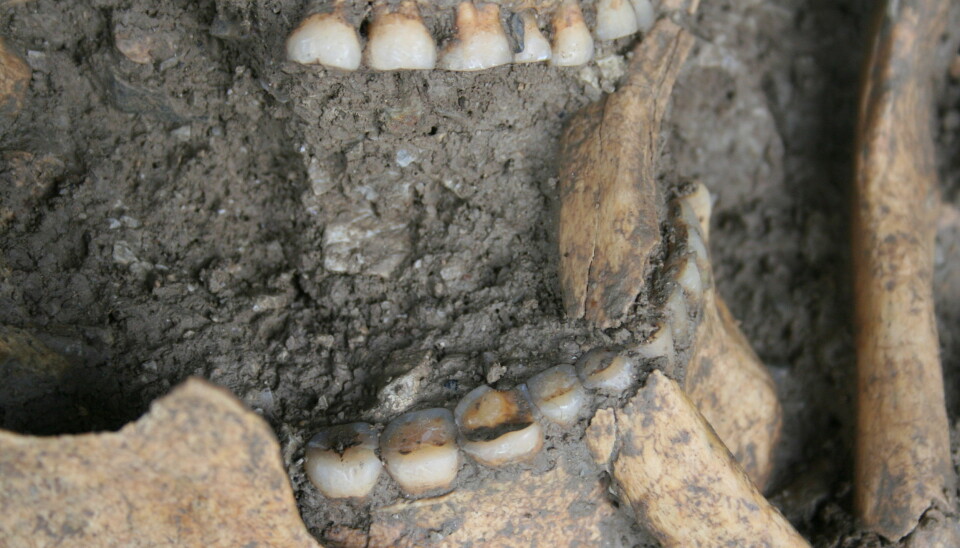De 8000 år gamle tennene, med kornrester, er godt bevart. (Foto: Dušan Bori)