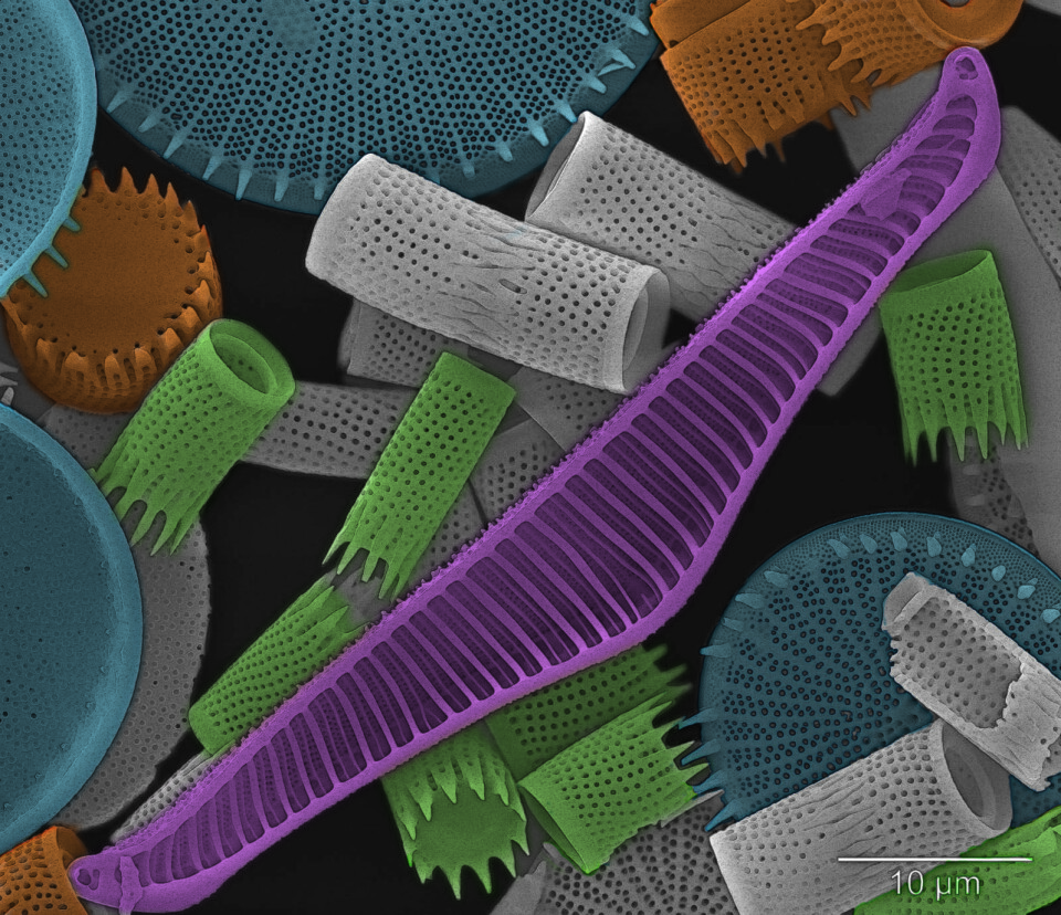 De encellede algene kan forskerne se ved hjelp av elektronmikroskop. Det kan ta opptil ett år å rense en sedimentprøve tilstrekkelig for å ta et slikt bilde. (Fargene er lagt til.) (Foto: Ulrike Hoff)