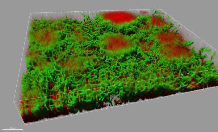 Konfokalmikroskopfoto av en cirka 0,1 millimeter høy biofilm med Bacillus-bakterier. Biofilmen har soppformede strukturer som står opp fra underlaget. Levende celler er vist i grønt, døde i rødt. (Foto: Farmasøytisk institutt, UiO) Konfokalmikroskopfoto av en cirka 0,1 millimeter høy biofilm med Bacillus-bakterier. Biofilmen har soppformede strukturer som står opp fra underlaget. Levende celler er vist i grønt, døde i rødt. (Foto: Farmasøytisk institutt, UiO)