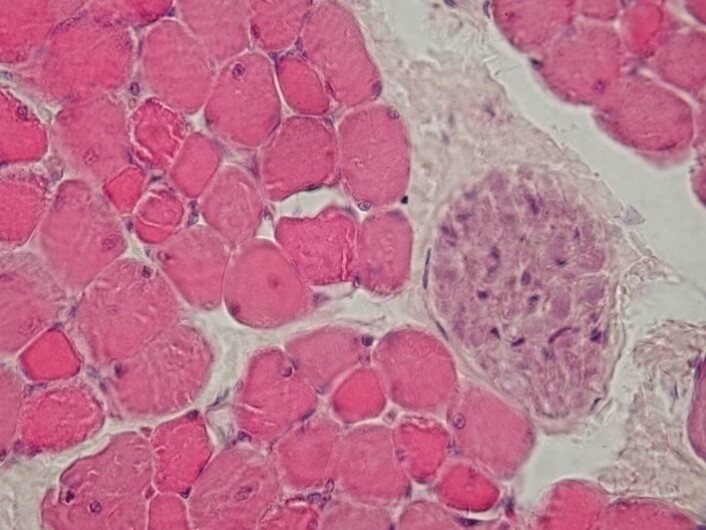 Bildet viser et tverrssnitt av muskelceller. (Foto: Department of Histology, Jagiellonian University Medical College. CC BY-SA 3.0) Bildet viser et tverrssnitt av muskelceller. (Foto: Department of Histology, Jagiellonian University Medical College. CC BY-SA 3.0)
