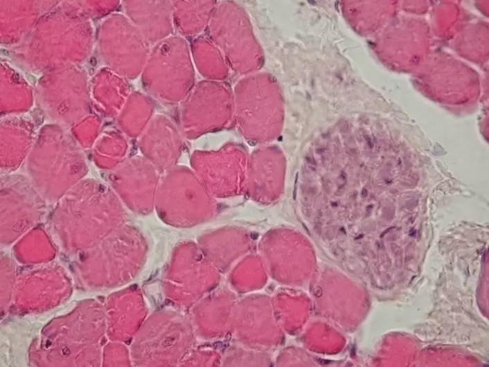 Bildet viser et tverrssnitt av muskelceller. (Foto: Department of Histology, Jagiellonian University Medical College. CC BY-SA 3.0)