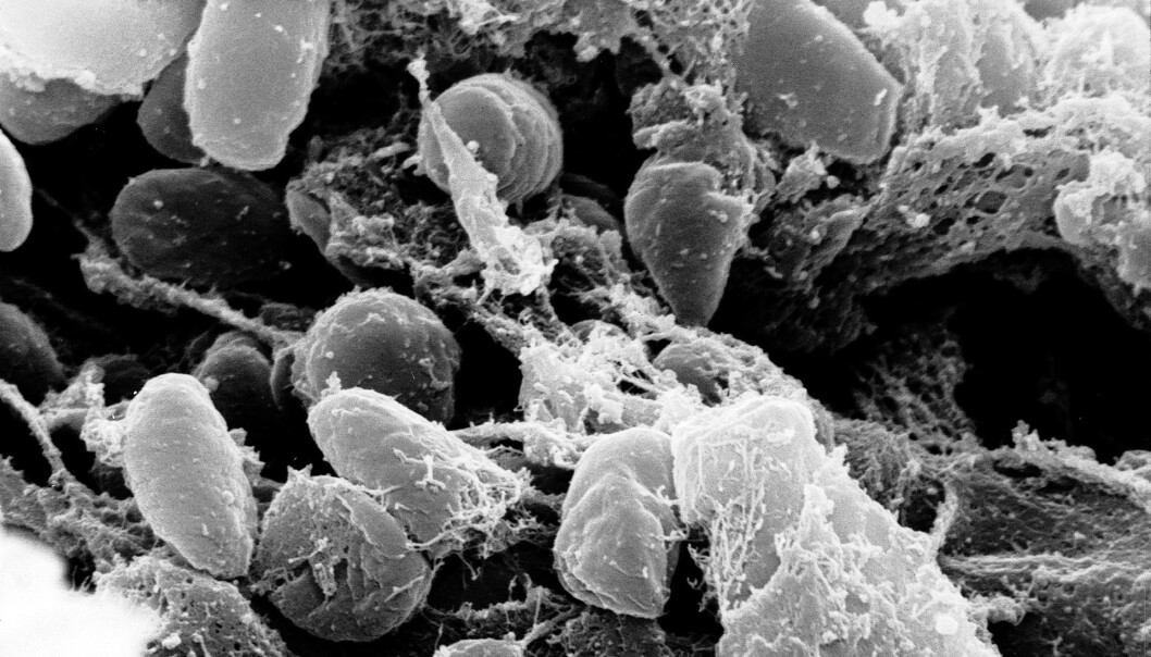 Elektronmikroskop-bilde av bakterien Y.pestis. (Bilde: Rocky Mountain Laboratories, NIAID, NIH Elektronmikroskop-bilde av bakterien Y.pestis. (Bilde: Rocky Mountain Laboratories, NIAID, NIH