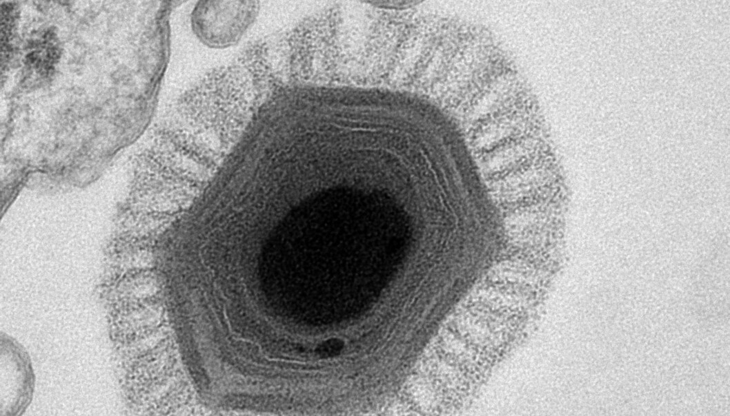 Her er et kjempevirus med navnet Megavirus chilensisa. Det ble funnet i havet utenfor Chile. (Foto: AFP Photo / IGS-CNRS / C. Abergel) Her er et kjempevirus med navnet Megavirus chilensisa. Det ble funnet i havet utenfor Chile. (Foto: AFP Photo / IGS-CNRS / C. Abergel)