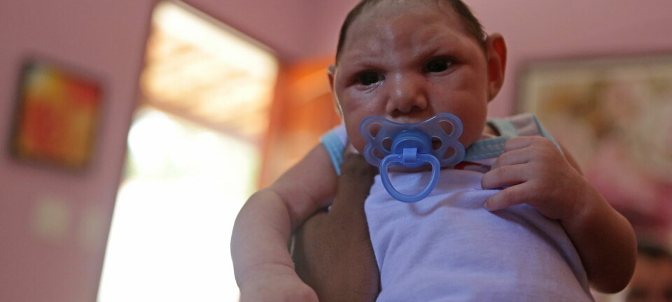 Bildet viser den brasilianske babyen Luiz Philipe i Marica, Rio de Janeiro, som har mikrocefali. Zikavirus mistenkes for å være årsaken.  (Foto: Zuma Press/Scanpix)
