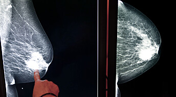 B-mennesker hadde større risiko for brystkreft, ifølge ny studie