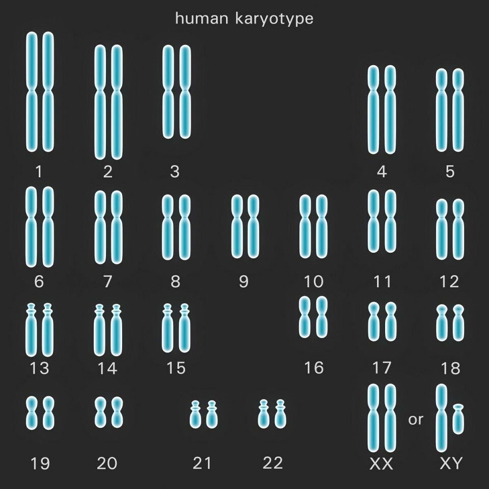 Menneskets kromosomer. (Foto: Shutterstock, NTB scanpix)