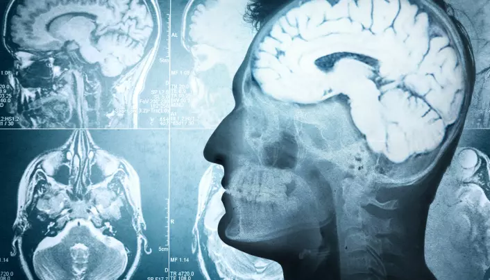 Ny studie: Pusten kan påvirke rensing av hjernen