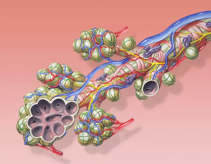 Illustrasjon av de minste forgreiningene av luftrøret i lungene. Sekkene på enden kalles alveoler. På utsiden ligger små tynne blodårer. (Foto: (Illustrasjon: Patrick J. Lynch/Wikimedia commons.))