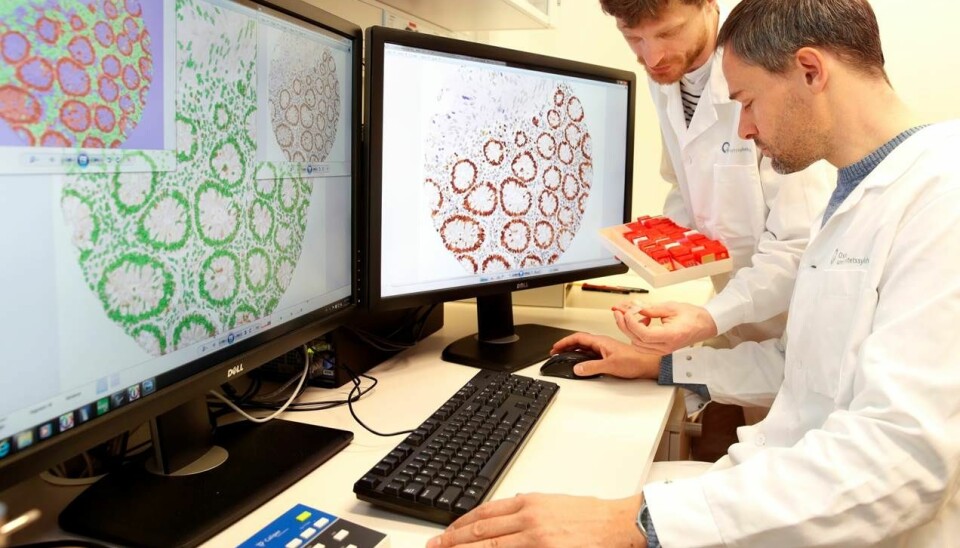 Forsker Jarle Bruun og stipendiat Peter Wold Eide. Her vises et snitt av en normal slimhinnebiopsi fra tarm.  (Foto: Oslo universitetssykehus)