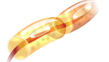 Myelin (illustert i gul) er et fettaktig stoff som danner en isolerende skjede rundt nerven. (Foto: Tefi/Shutterstock/NTB scanpix) Myelin (illustert i gul) er et fettaktig stoff som danner en isolerende skjede rundt nerven. (Foto: Tefi/Shutterstock/NTB scanpix)