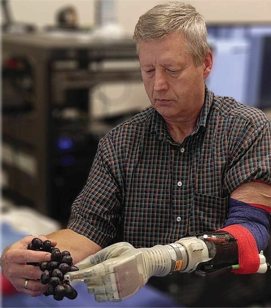 Keven Walgamot har amputert en av armene. Her håndterer han druer med den nye protesearmen 'Luke'. (Foto: University of Utah)