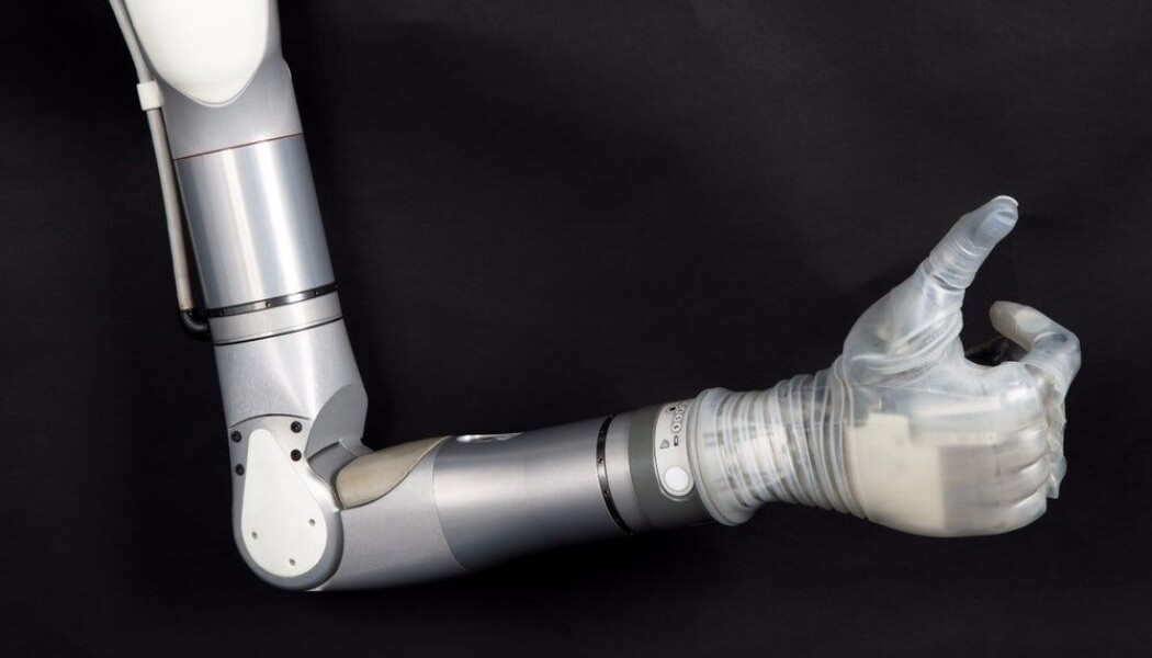 Tommel opp for protesearmen LUKE. (Foto: Modius Bionics) Tommel opp for protesearmen LUKE. (Foto: Modius Bionics)