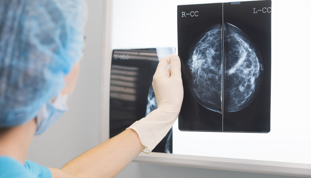 Ny metode avslører alle proteinene som er til stede hver enkelt svulst. (Illustrasjonsfoto: Thomas Andreas / Shutterstock / NTB scanpix) Ny metode avslører alle proteinene som er til stede hver enkelt svulst. (Illustrasjonsfoto: Thomas Andreas / Shutterstock / NTB scanpix)