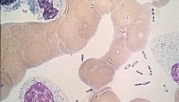 Pestbakterien sett i mikroskop: Den har en karakteristisk form som minner om en sikkerhetsnål. (Foto: U.S. Center for Disease Control, Wikimedia Commons). Pestbakterien sett i mikroskop: Den har en karakteristisk form som minner om en sikkerhetsnål. (Foto: U.S. Center for Disease Control, Wikimedia Commons).