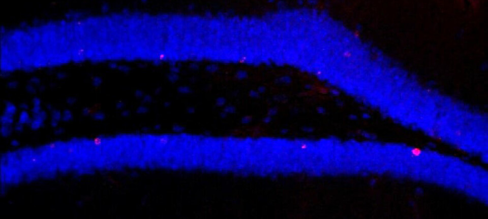 Bilde av hippokampusen til en av musene som ble behandlet med antibiotika. Her dannes det bare noen få nye hjerneceller - markert i rødt.  (Foto: Susanne Wolf/MDC)