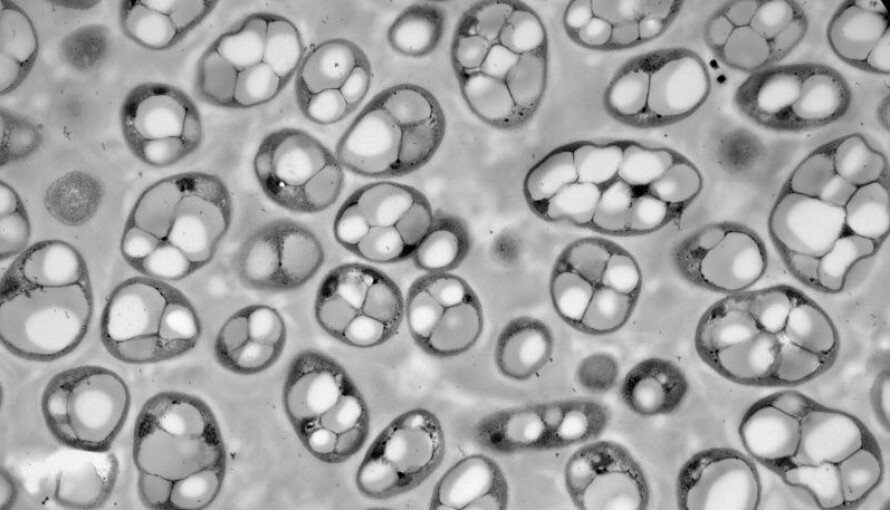 Opptil 80–90 prosent av lagret næring i bakterier kan være plastlignende. Dette mikroskopbilde viser den PHA-produserende bakterien Ralstonia eutropha. De hvite feltene er bakterienes PHA-lagre. (Foto: Institutt for kjemi, UiT)