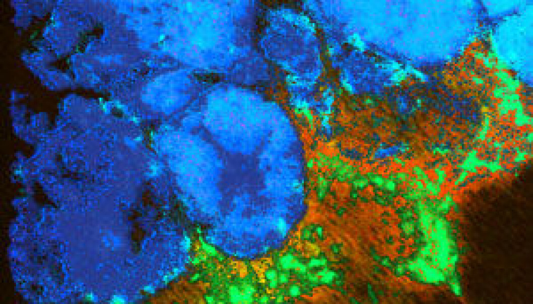 By continuously taking pictures with a microscope of breast cancer tumours in mice and putting the pictures together to make films, researchers are trying to determine how cancer cells are affected by surrounding tissue. This picture is from one such film. (Photo: Mikala Egeblad). By continuously taking pictures with a microscope of breast cancer tumours in mice and putting the pictures together to make films, researchers are trying to determine how cancer cells are affected by surrounding tissue. This picture is from one such film. (Photo: Mikala Egeblad).