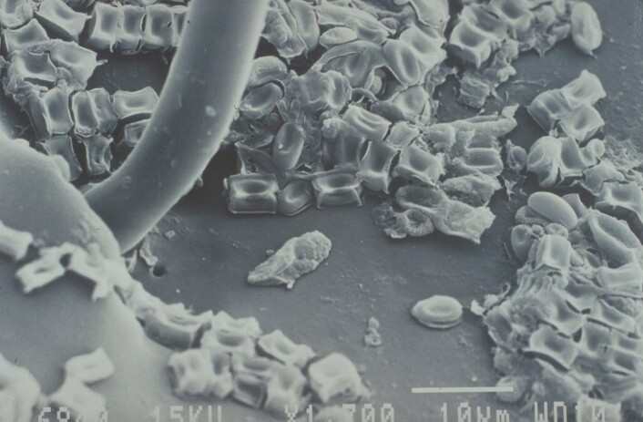 Oversiden av en granbarkebille forstørret 1700 ganger. De lyse «putene» er sporer av sopp som fungerer som biologiske våpen når billene angriper friske grantrær (Scanning elektronmikroskop) Foto: NIBIO Oversiden av en granbarkebille forstørret 1700 ganger. De lyse «putene» er sporer av sopp som fungerer som biologiske våpen når billene angriper friske grantrær (Scanning elektronmikroskop) Foto: NIBIO