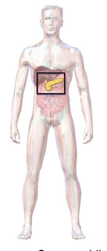 Her ligger bukspyttkjertelen. Hos de som har diabetes type-1, produserer ikke organet det livsviktige hormonet insulin. (Foto: (Illustrasjon: Blausen.com staff. "Blausen gallery 2014". Wikiversity Journal of Medicine. DOI:10.15347/wjm/2014.010. ISSN 20018762.)) Her ligger bukspyttkjertelen. Hos de som har diabetes type-1, produserer ikke organet det livsviktige hormonet insulin. (Foto: (Illustrasjon: Blausen.com staff. "Blausen gallery 2014". Wikiversity Journal of Medicine. DOI:10.15347/wjm/2014.010. ISSN 20018762.))