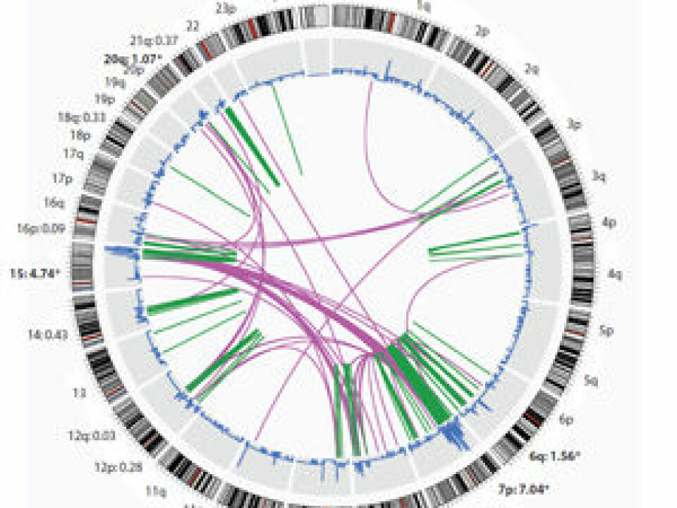 The big wheel shows the entire genome with 24 chromosomes. The curved lines in the middle show how the gene materials have swapped places. The mathematical pattern shows that the patient has a serious type of breast cancer. (Figure: Ole Christian Lingjærde)