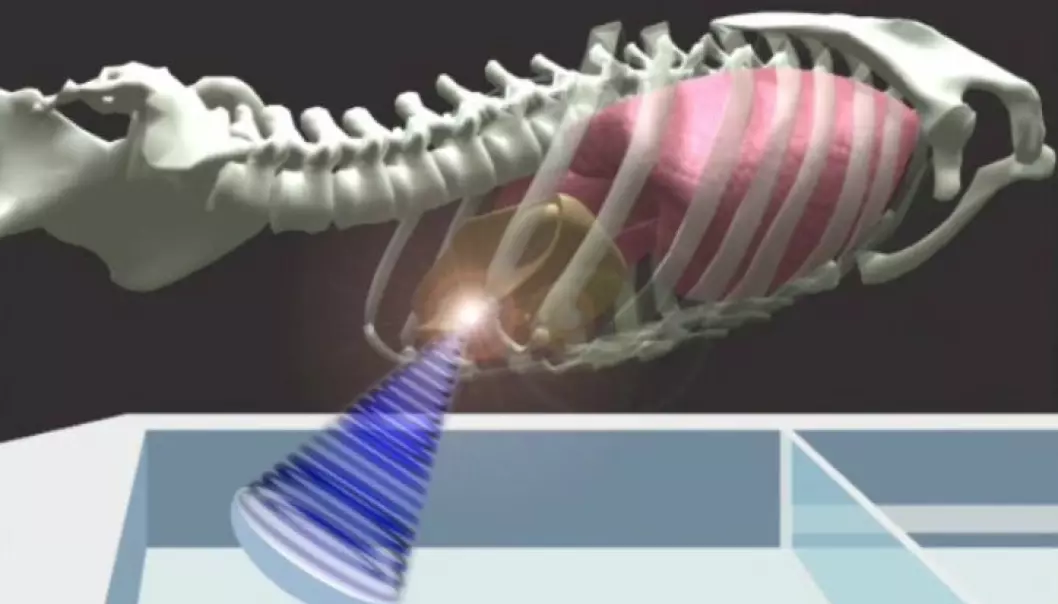 What the SINTEF scientists want to do is to visualize and track the movements of soft tissue by means of 4D, i.e. three-dimensional images in real time. (Illustation: SINTEF).