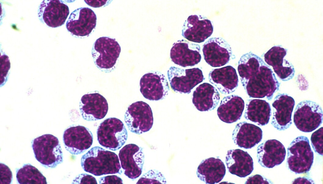 Natural killer cells (NK cells) can be part of the solution for dangerous side effects arising from stem cell transplantation.( Photo: Bent Rolstad) Natural killer cells (NK cells) can be part of the solution for dangerous side effects arising from stem cell transplantation.( Photo: Bent Rolstad)