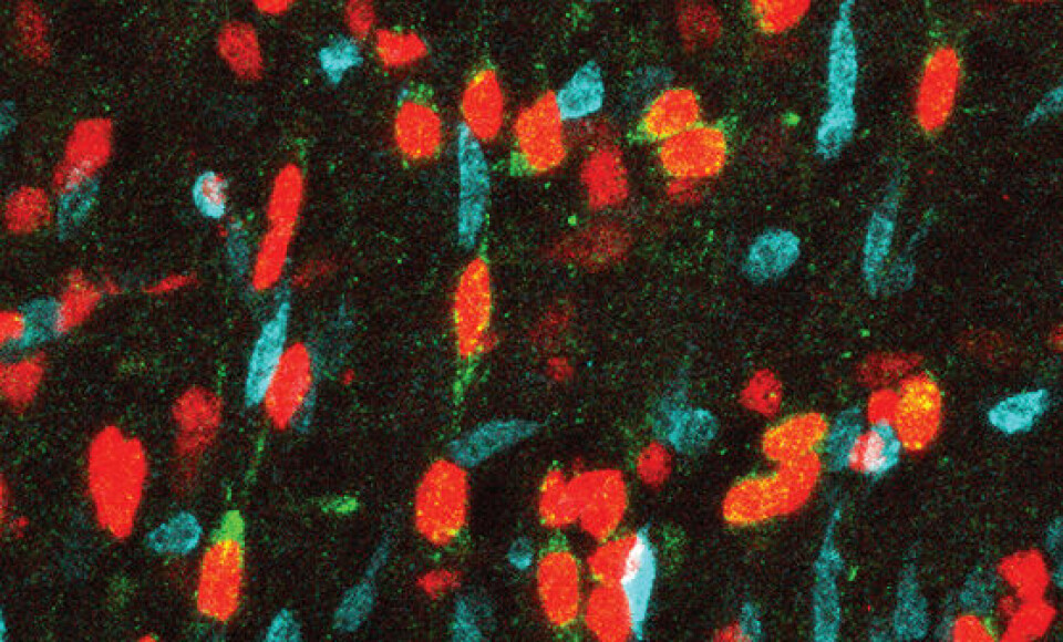 Proteinet AXL er grønnfarget i dette mikroskopbildet av en menneskehjerne under utvikling. Nervecellene er blå, og gliacellene, en annen type hjerneceller, er røde. (Foto: (Bilde: Tomasz Nowakowski))