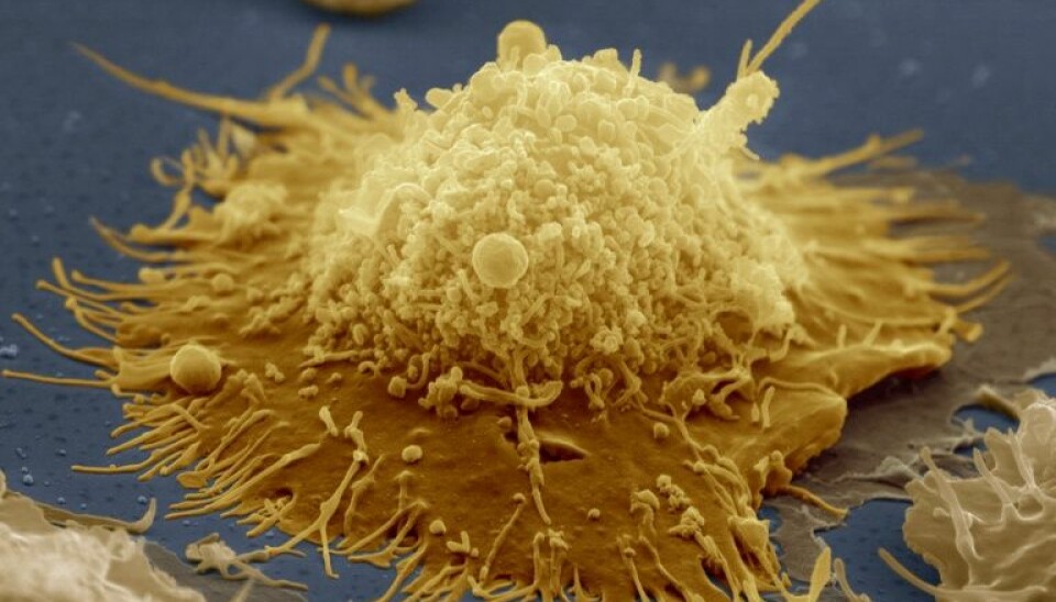 Bildet viser en B-celle. B-celler er lymfocytter, som igjen er en variant av hvite blodceller. Disse cellene tilpasser seg etter bestemte bakterier, slik at de kan kjenne igjen et angrep senere. Denne funksjonen gjør oss immune mot visse bakterier.  (Foto: Science Photo Library/NTB Scanpix)