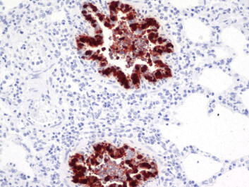Lung tissue from pig attacked by influenza A (H1N1) 2009. Infected areas are dark. (Photo: Mette Valheim)
Lung tissue from pig attacked by influenza A (H1N1) 2009. Infected areas are dark. (Photo: Mette Valheim)