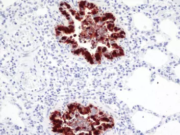Lung tissue from pig attacked by influenza A (H1N1) 2009. Infected areas are dark. (Photo: Mette Valheim)
