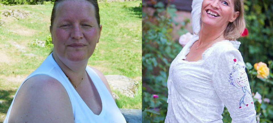Hege Friberg ble slankeoperert for sju år siden. Det forandret livet hennes, men ikke helt på den måten hun hadde trodd på forhånd. (Foto: privat)