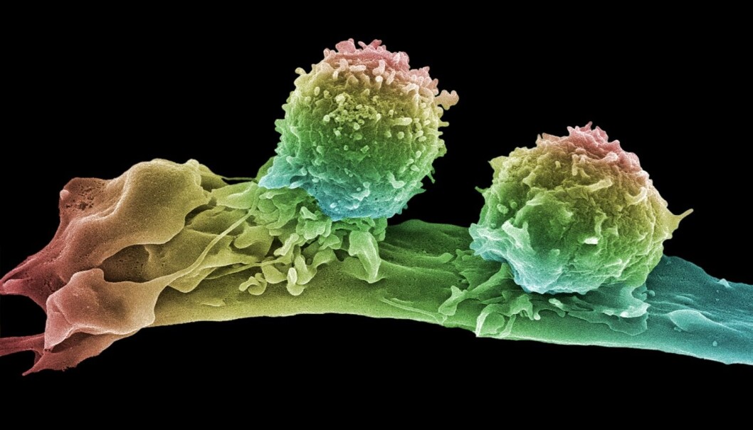 null (Foto: Science Photo Library, NTB scanpix) null (Foto: Science Photo Library, NTB scanpix)