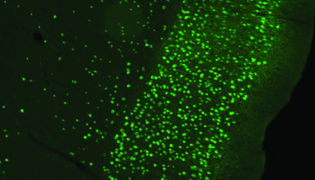 Section of rat brain. The image shows cells in the entorhinal cortex that have been infected by a virus injected into the hippocampus. The virus carrying the gene for a green fluorescent dye makes it possible to view the infected cells. (Photo: Kavli Institute) Section of rat brain. The image shows cells in the entorhinal cortex that have been infected by a virus injected into the hippocampus. The virus carrying the gene for a green fluorescent dye makes it possible to view the infected cells. (Photo: Kavli Institute)