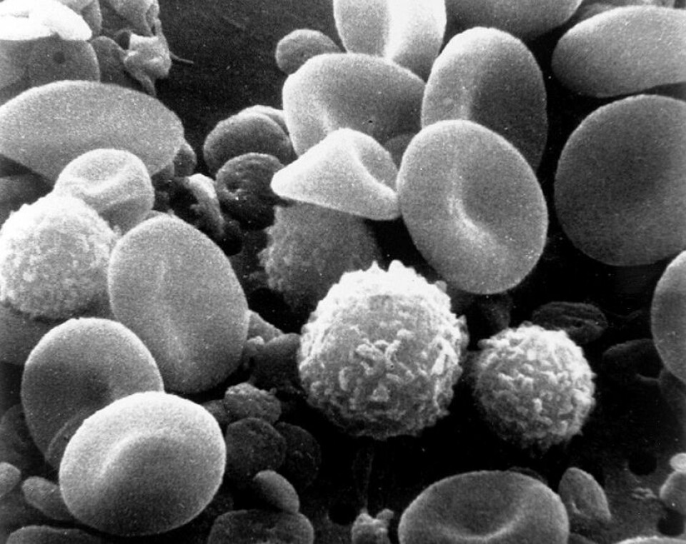 Et nærbilde av blod. Du kan blant annet se røde blodceller og hvite blodceller. De knudrete kulene hører til lymfocytt-gruppen. Både B- og C-cellene hører til innenfor lymfocytt-gruppa. (Foto: Bruce Wetzel/Harry Schaefer/Wikimedia commons.)