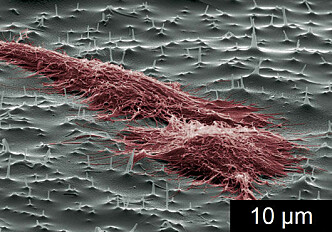 Nano-needles for cells