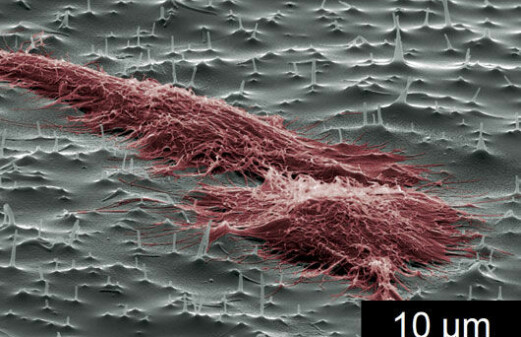 Nano-needles for cells