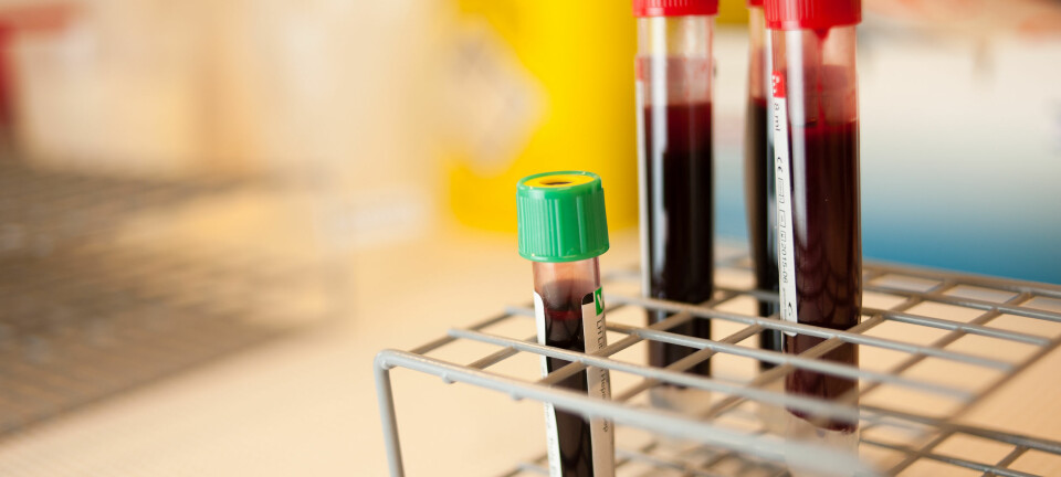 Blodprøver kan vise om det er ubalanse i hormonene dine. Det er allikevel ikke sikkert du er syk. (Illustrasjonsfoto: Øystein H. Horgmo, UiO)