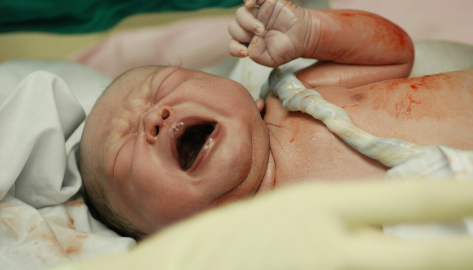 Keisersnitt kan gi komplikasjoner. Det kan en vanlig fødsel også.  (Foto: ARZTSAMUI / Shutterstock / NTB scanpix)