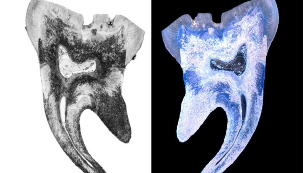 An ancient human tooth cut in two. The black flecks in the left-hand image show that it has been broken down by bacteria. Photo: Hege Ingjerd Hollund An ancient human tooth cut in two. The black flecks in the left-hand image show that it has been broken down by bacteria. Photo: Hege Ingjerd Hollund